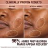 DARK SPOT CORRECTING INVISIBLE UV DUO Hautpflege-Set