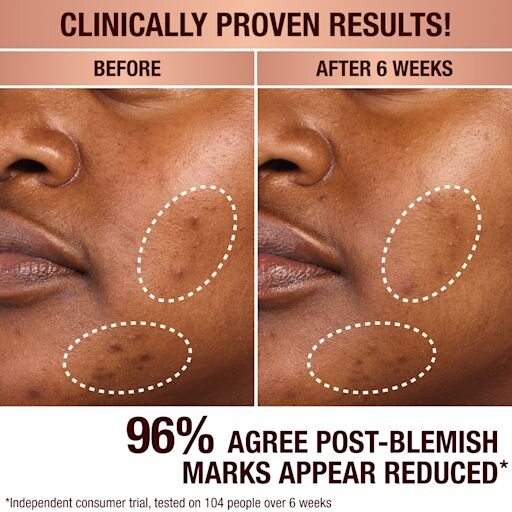 DARK SPOT CORRECTING INVISIBLE UV DUO Hautpflege-Set